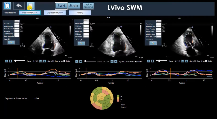 Israel’s DiA gets $14M to expand AI-driven ultrasound analysis